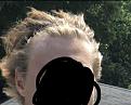 Click image for larger version

Name:	Hairline 2 Years ago.jpg
Views:	129
Size:	77.9 KB
ID:	495276