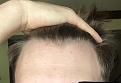 Click image for larger version

Name:	Front Hairline.jpg
Views:	194
Size:	67.5 KB
ID:	495280