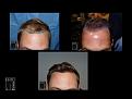 Click image for larger version

Name:	Slide2.JPG
Views:	182
Size:	77.8 KB
ID:	495326