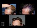 Click image for larger version

Name:	Slide4.JPG
Views:	184
Size:	93.0 KB
ID:	495328