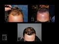 Click image for larger version

Name:	Slide5.JPG
Views:	189
Size:	81.4 KB
ID:	495329