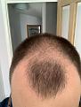 Click image for larger version

Name:	Hair 2.jpg
Views:	216
Size:	85.6 KB
ID:	495365