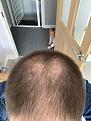 Click image for larger version

Name:	Hair.jpg
Views:	193
Size:	91.5 KB
ID:	495366