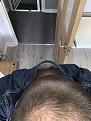 Click image for larger version

Name:	Hair 4.jpg
Views:	206
Size:	91.2 KB
ID:	495367