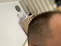 Click image for larger version

Name:	Hair 6.jpg
Views:	210
Size:	79.3 KB
ID:	495368