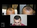 Click image for larger version

Name:	Slide5.JPG
Views:	180
Size:	77.6 KB
ID:	495536