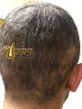 Click image for larger version

Name:	shock-hair-loss-1-2.jpg
Views:	216
Size:	95.0 KB
ID:	495596