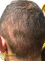 Click image for larger version

Name:	shock-hair-loss-3.jpg
Views:	243
Size:	95.6 KB
ID:	495597