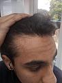 Click image for larger version

Name:	IMG_20200715_123944.jpg
Views:	170
Size:	93.6 KB
ID:	495732