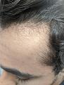 Click image for larger version

Name:	IMG_20200715_123758.jpg
Views:	167
Size:	94.7 KB
ID:	495735