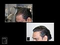 Click image for larger version

Name:	Slide1.JPG
Views:	182
Size:	69.9 KB
ID:	495812