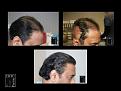 Click image for larger version

Name:	Slide4.JPG
Views:	183
Size:	94.2 KB
ID:	495815