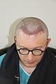 Click image for larger version

Name:	8b Second treatment New hair line.jpg
Views:	435
Size:	45.4 KB
ID:	495836