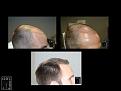 Click image for larger version

Name:	Slide4.JPG
Views:	206
Size:	76.0 KB
ID:	495997
