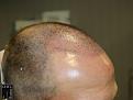Click image for larger version

Name:	Slide9.jpg
Views:	199
Size:	56.4 KB
ID:	496002