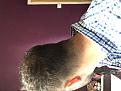 Click image for larger version

Name:	Left side of head.jpg
Views:	184
Size:	91.0 KB
ID:	496075