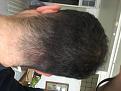 Click image for larger version

Name:	Back of the head.jpg
Views:	184
Size:	83.8 KB
ID:	496076