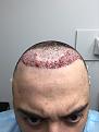 Click image for larger version

Name:	Post_Op_03.jpg
Views:	248
Size:	83.5 KB
ID:	496163