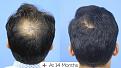 Click image for larger version

Name:	Kulat sagar website 01.jpg
Views:	165
Size:	96.3 KB
ID:	498126