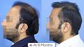 Click image for larger version

Name:	Saurabh  Jain  Website post 02 (1).jpg
Views:	145
Size:	86.5 KB
ID:	498164