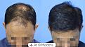Click image for larger version

Name:	Before After For Website 03 (2).jpg
Views:	157
Size:	93.4 KB
ID:	498185