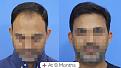 Click image for larger version

Name:	Before After For Website 06 (2).jpg
Views:	150
Size:	65.2 KB
ID:	498186