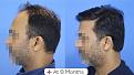 Click image for larger version

Name:	Before After For Website 05 (2).jpg
Views:	151
Size:	83.6 KB
ID:	498187