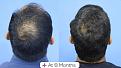 Click image for larger version

Name:	Before After For Website 04 (2).jpg
Views:	150
Size:	86.9 KB
ID:	498188
