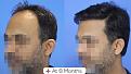 Click image for larger version

Name:	Before After For Website 02 (2).jpg
Views:	145
Size:	83.4 KB
ID:	498189