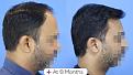 Click image for larger version

Name:	Before After For Website 01 (2).jpg
Views:	141
Size:	93.8 KB
ID:	498190