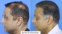 Click image for larger version

Name:	Kishore Lulla Website 03.jpg
Views:	152
Size:	89.1 KB
ID:	498294