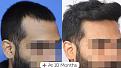 Click image for larger version

Name:	WhatsApp Image 2021-05-26 at 7.13.12 PM (1).jpg
Views:	127
Size:	19.5 KB
ID:	498413