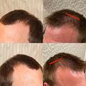 Click image for larger version

Name:	unnamed.jpg
Views:	226
Size:	90.4 KB
ID:	498543