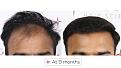 Click image for larger version

Name:	15072021 Mahipal Singh Website 01.jpg
Views:	173
Size:	97.0 KB
ID:	498559