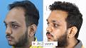 Click image for larger version

Name:	Shivansh Rajaida Website 03.jpg
Views:	175
Size:	96.1 KB
ID:	498598
