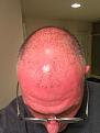Click image for larger version

Name:	Before procedure 1.jpg
Views:	231
Size:	88.6 KB
ID:	499193