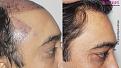 Click image for larger version

Name:	close left compare.jpg
Views:	141
Size:	99.5 KB
ID:	499352