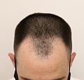 Click image for larger version

Name:	fue1733 (9).jpg
Views:	231
Size:	88.8 KB
ID:	499497