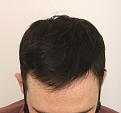 Click image for larger version

Name:	fue1733 (5).jpg
Views:	254
Size:	87.7 KB
ID:	499499