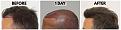 Click image for larger version

Name:	Before-Surgical-After-LeftProfile-New.jpg
Views:	388
Size:	106.9 KB
ID:	499521