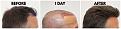 Click image for larger version

Name:	Before-Surgical-After-RightProfile-New.jpg
Views:	381
Size:	107.1 KB
ID:	499522