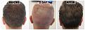 Click image for larger version

Name:	Before-Surgical-After-Donor-New.jpg
Views:	407
Size:	100.9 KB
ID:	499524