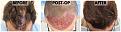 Click image for larger version

Name:	Before-Postop-After-Top.jpg
Views:	265
Size:	109.3 KB
ID:	499546