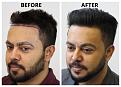 Click image for larger version

Name:	02-Before-After-LeftProfileAngle.jpg
Views:	290
Size:	86.6 KB
ID:	499584