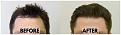 Click image for larger version

Name:	Hairline.jpg
Views:	80
Size:	93.7 KB
ID:	499652