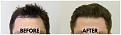 Click image for larger version

Name:	Hairline.jpg
Views:	181
Size:	93.7 KB
ID:	499652