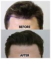 Click image for larger version

Name:	HairlineCloseup.jpg
Views:	182
Size:	85.2 KB
ID:	499653