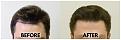 Click image for larger version

Name:	HairlineSlightTilt.jpg
Views:	164
Size:	91.4 KB
ID:	499654
