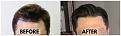 Click image for larger version

Name:	HairlineTakenByPatient.jpg
Views:	172
Size:	96.1 KB
ID:	499655