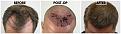 Click image for larger version

Name:	Before-After-45Degree.jpg
Views:	179
Size:	105.6 KB
ID:	499709